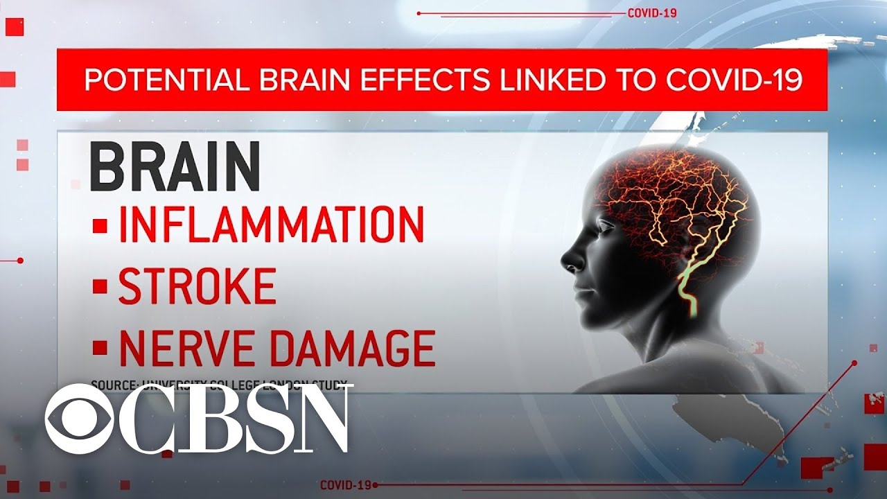 Scientists warn brain damage may be linked to COVID-19