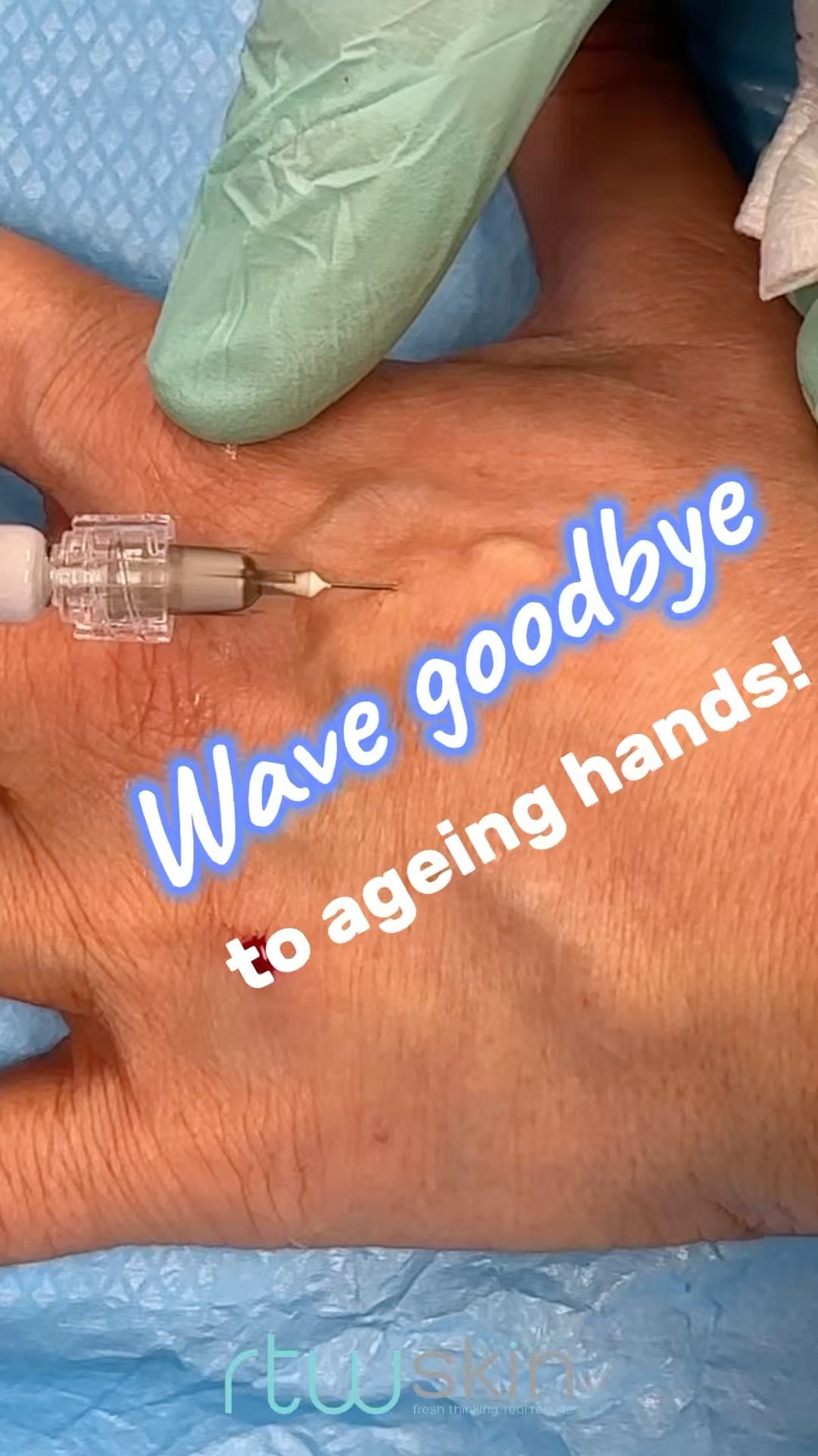 Wave ageing hands goodbye⌠#rtwskin