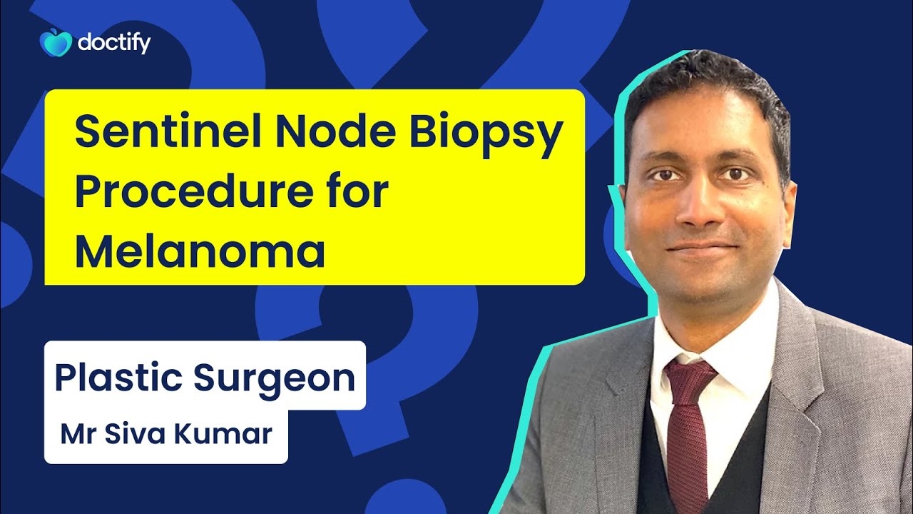 Sentinel Node Biopsy Procedure for Melanoma